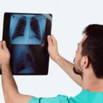 Patient education series: Rib Fractures